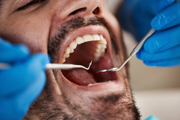 Best Same-Day Emergency Dental Services in Waelder, TX