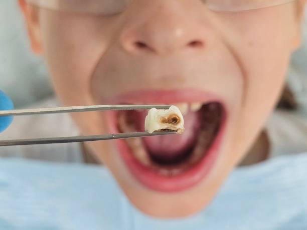 Best Pediatric Emergency Dentist in Waelder, TX